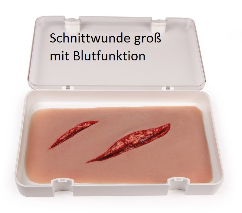 Wundmoulage Schnittwunde